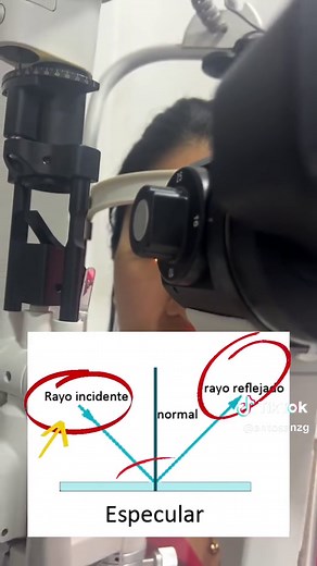 Técnicas directas de la biomicroscopia: Reflexión especular. #saludvisual #optometria #optometrista #optica #ojos