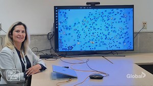 How AI is Revolutionizing Cancer Diagnosis: Dr. April Khademi Shares Insights