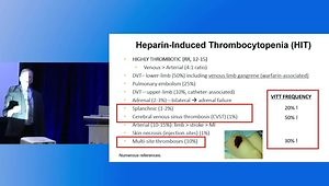 VITT-Like Monoclonal Gammopathy of Thrombotic Significance (MGTS): Background