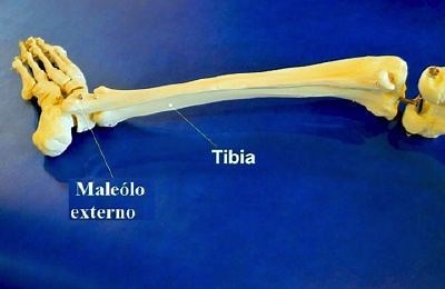 Fractura del maléolo externo. Síntomas y tratamiento | Fisiolution