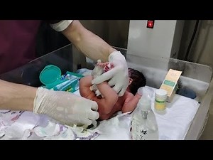 🍼 Newborn Baby with Abdominal Pain – Starting Suppository Treatment Under Proper Medical Protocol.