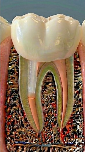 Root Canal Treatment & Fiber Post 🦷 3D Animation