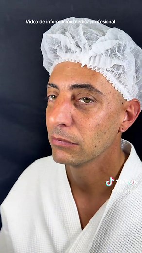 Nariz Ancha XXL ⚜️ RINO #rinoplastia #narizancha - Video con fines educativos de un procedimiento quirúrgico tan solicitado como una rinoplastia que no solo es estética sino también para poder mejorar la función ventilatoria. - La paciente dio su consentimiento de exhibir su resultado en redes sociales. - Cada paciente tiene un formato nasal, respuesta inflamatoria y tipo de piel. Por lo tanto cada resultado final es único.