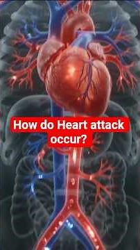 How a Heart Attack Happens | Myocardial Infarction, 3D Animation #heartattack #myocardialinfarction