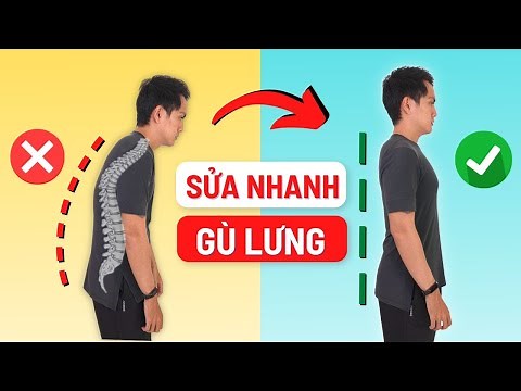 Humpback: Causes and Home Remedies | Nguyen Yoga