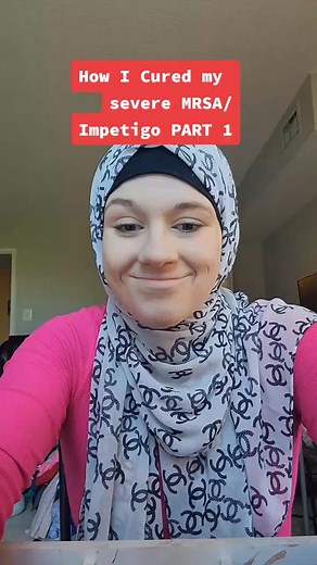 How I Cured Severe Impetigo and MRSA in Less Than Two Weeks