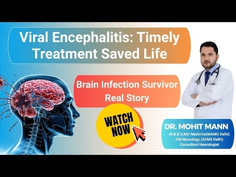 Severe Brain infection: From ICU to Normal Life Again : Dr Mohit Mann,Consultant Neurologist