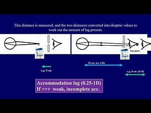 Optics course : Dynamic retinoscopy