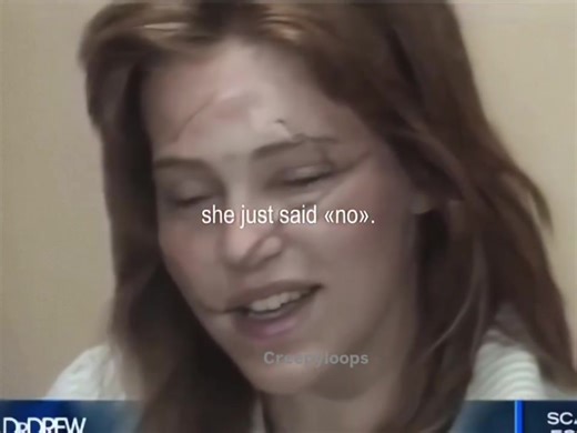 Marla Hanson was a rising New York model in the late 1980s when her life was shattered in 1988 by her ex-boyfriend Mark Hofmann, a man who refused to accept rejection. After months of stalking and threats, he forced his way into her apartment and slashed her face with a razor blade, admitting later that he didn't want to kill her - he wanted to destroy her beauty so she could never model again. The attack left Marla with severe facial injuries and deep emotional trauma, requiring years of recons