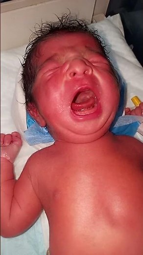 Gastrointestinal Issues: Gastroenteritis ("stomach flu") causes vomiting and diarrhea.