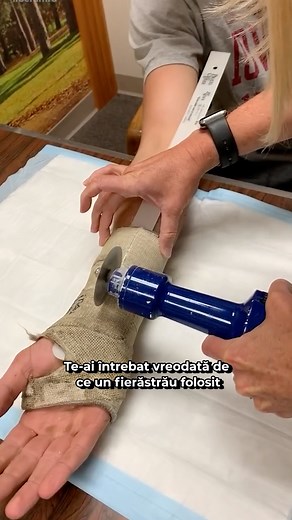 De ce fierăstrăul pentru gips nu taie #castremoval #romania #medicina | Liberam
