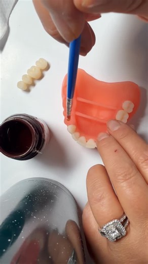 THE ēSSENTIAL DENTIST on Instagram: "Yep… we just learned how to 3D print dentures in-house. Our dentist and team have been training in digital denture design and 3D printing, so your new smile can be crafted with high-tech precision. Ready to upgrade your smile? DM us if you think you could benefit from an upgrade or new smile 😃"