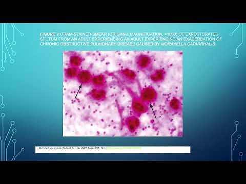 Moraxella catarrhalis