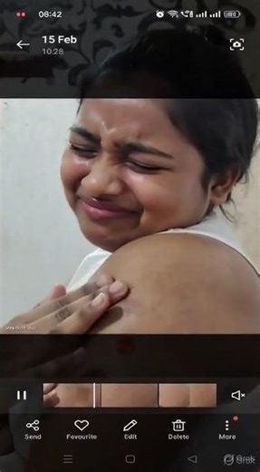 girl getting her injection on her navel #Shorts, #YouTubeShorts, #viral, #trending 10 March 2026