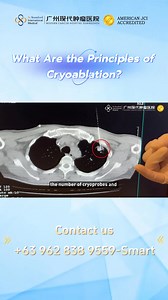 【Anti-cancer Technologies】 Cryotherapy or “extreme cold”❄️+“extreme...