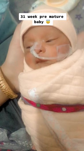 31 Week Premature Baby: A Miracle Story