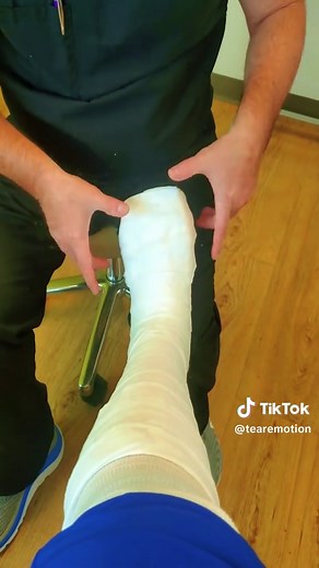 How to Properly Cast a Leg for Beginners