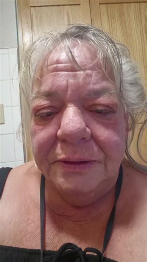 You Hate Me on Instagram: "The day of the great dark is upon us The sky turns red and boils overhead The earth beneath me becomes gelatinous The skin begins to shrink and compress me The unimaginable weight I experience The unimaginable heat I experience Not even for a moment can I comprehend this I suffer as the walls close in around me The walls of my chamber were too tight The floating eye sees all It peers through me in my final form Sucked dry of anything I once was An empty husk in a bath 