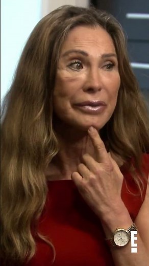 Michelle got her lips done in Asia for $200?? #botched