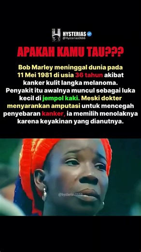 Bob Marley Meninggal Karena Luka Kecil?!