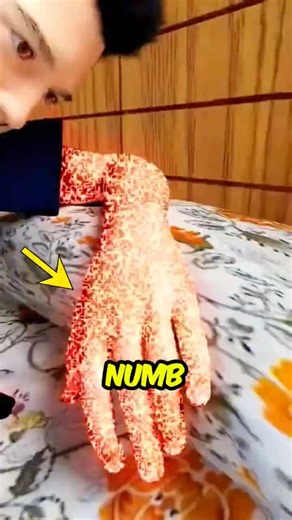 Why Your Arm “Falls Asleep” (That Tingling Explained)