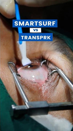 SmartSurf vs Trans PRK | Which No-Touch Laser Eye Surgery Is Better?