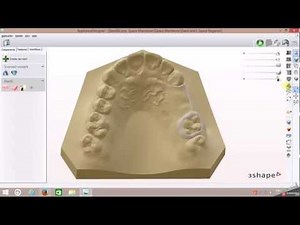 Digital Band & L Space Regainer