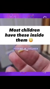 If your pet sleeps in your bed but you’ve never done a parasite cleanse… this is your sign. We deworm our dogs. We deworm our cats. But no one talks about deworming humans. That’s the part that’s wild. You live with animals, They go outside, They sniff, lick, eat who-knows-what… and then come back into your home like everything’s normal. Meanwhile they’re bringing parasites into your environment your couch, your bed, your child’s face. Parasites don’t need an invitation. And yes, they infect hum