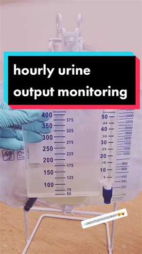 #fypシ #foryoupage #nursesoftiktok #learnontiktok #cna #hca #studentnurse #nursingschool #urine #catheter #urineoutput #greysanatomy #nurselife