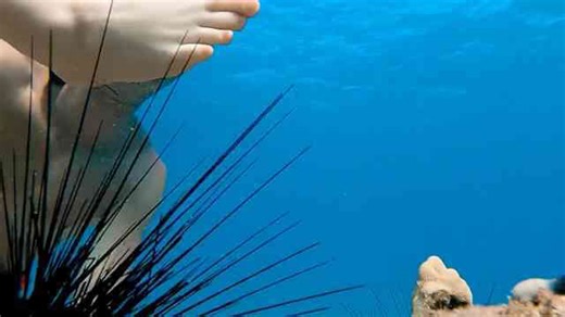 How a hyper realistic fake foot was used to test a sea urchin’s spines
