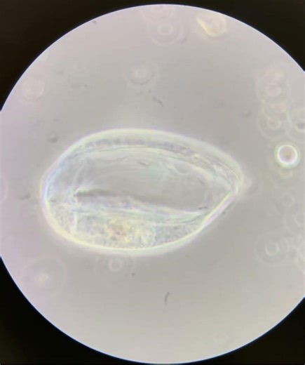 Lembadion magnum under microscope #microscopy