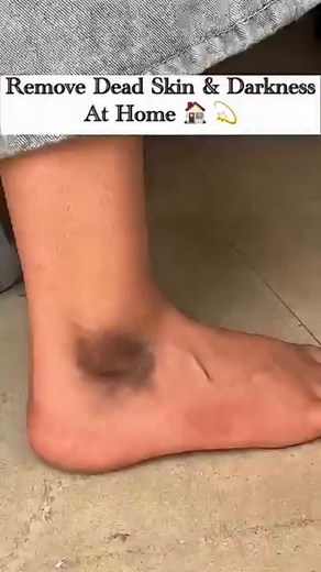 4.6K views · 3.8K reactions | Fair Feet Tips | Clean Dirt & Tanning | Remove Tanning & Dead Skin #trendingshorts # | anjanaverma.19 | Facebook