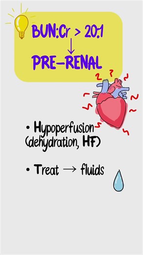 AKI Made Easy in 45s | USMLE Step 1 High-Yield Algorithm (BUN:Cr + Causes)