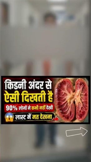 Doctor shows real kidney! ⚠️ These 3 mistakes cause kidney rot | Kidney Failure Symptoms