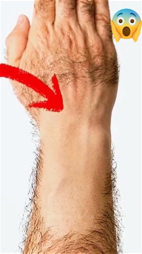 Remove Unwanted Facial Hair Naturally At Home | Best Hair Removal Remedy #facialhair #unwantedhair