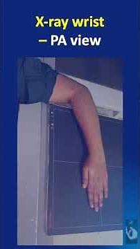 Shorts #192: X-ray Wrist PA view: How to take this X-ray?