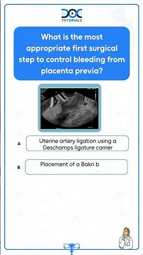 Master the management of Placenta Previa with DocTutorials! 🩺✨