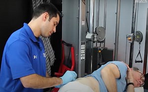 Video | Dry Needling by a Physical Therapist