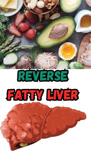 Fatty Liver - Top 5 foods for Fast Recovery #reel #reels #fattyliver #liverfoods #liverhealth