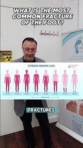 Toe fractures: the most common foot fracture!