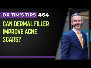 Can dermal filler improve acne scars?