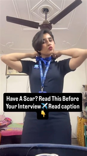 Our scars coming between you and your cabin crew ￼ journey Watch it #subscibe #flightattendant