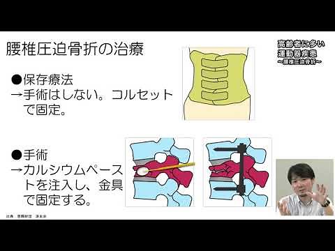 2 1高齢者に多い運動器疾患〜腰椎圧迫骨折~
