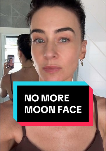 Moon Face and Hashimoto's: Understanding the Symptoms