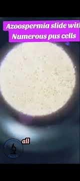 Tout sur le spermogramme 😱😱#microscope #spermatozoide#laboratory