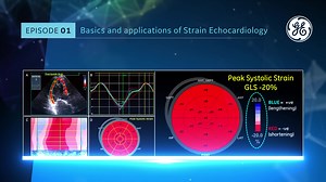 Find out all you need to know about! An online learning community led by key opinion leaders who will share their experiences | GE HealthCare