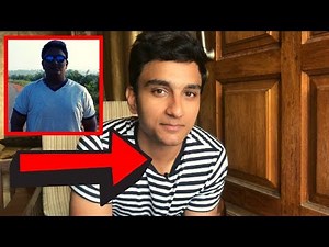 How I changed my Skin ? | Healthy Skin | Acanthois Nigricans Face transformation (NOT COMPLEXION)