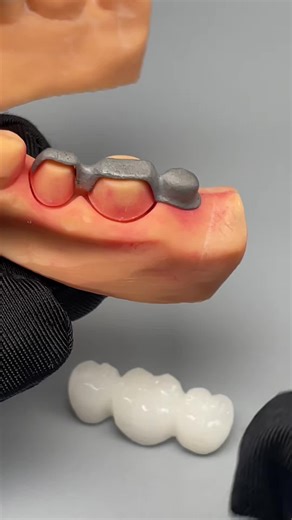 dentallab_Rock on Instagram: "Want to get a price list,please contact my WhatsApp: +86-15393729102, WhatsApp link: http://wa.me/8615393729102, our sale coworker will tell you more details, like brochure...#dentist#dentallab#teeth#denture #dentaltreatment #3Dprinter #Thefastest laboratory #crowns #Dentalimplant #Zirconiacrown #PFM #CAD #CAM"