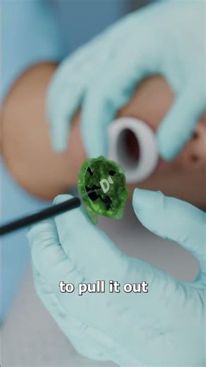 She Swallowed Her Fitness Tracker By Accident 😨