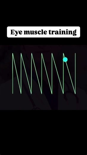 Struggling with eye strain or screen fatigue? 👀Eye muscle training can help improve focus!